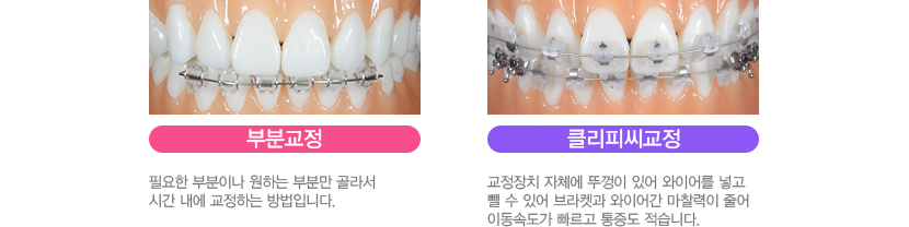 빠른교정을 원한다면?