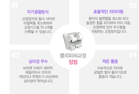 클리피씨교정 장점