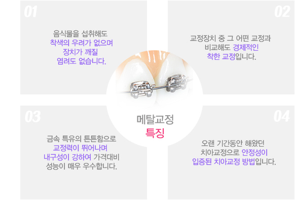 메탈교정특징